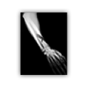 Arm xray
