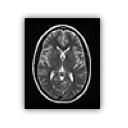 Brain mri