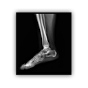 Leg xray